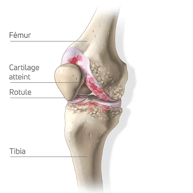 Anatomie du genou OA
