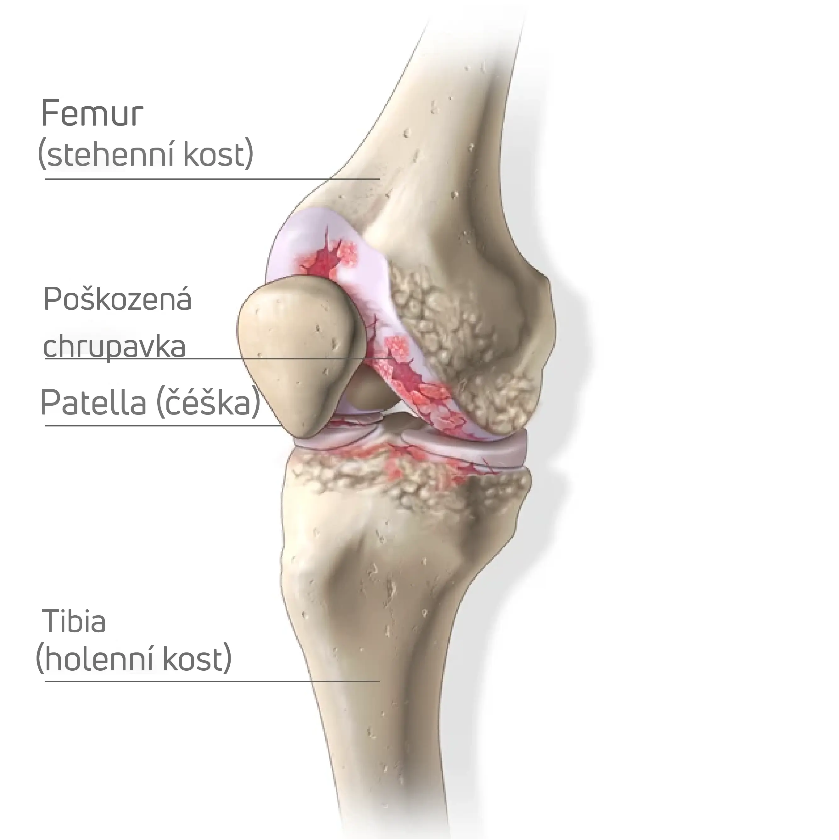 Anatomie kolena OA